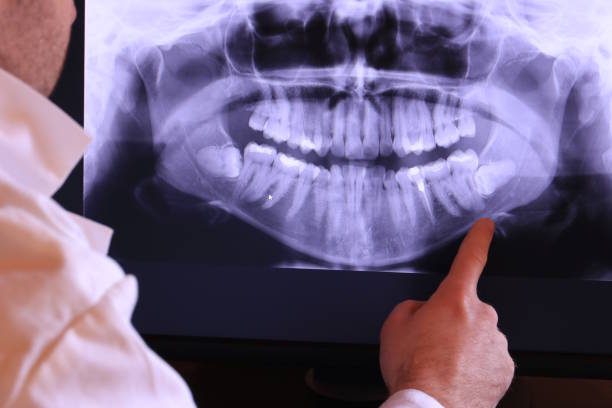 Best Urgent Dental Care for Toothaches in Lakeport, CA